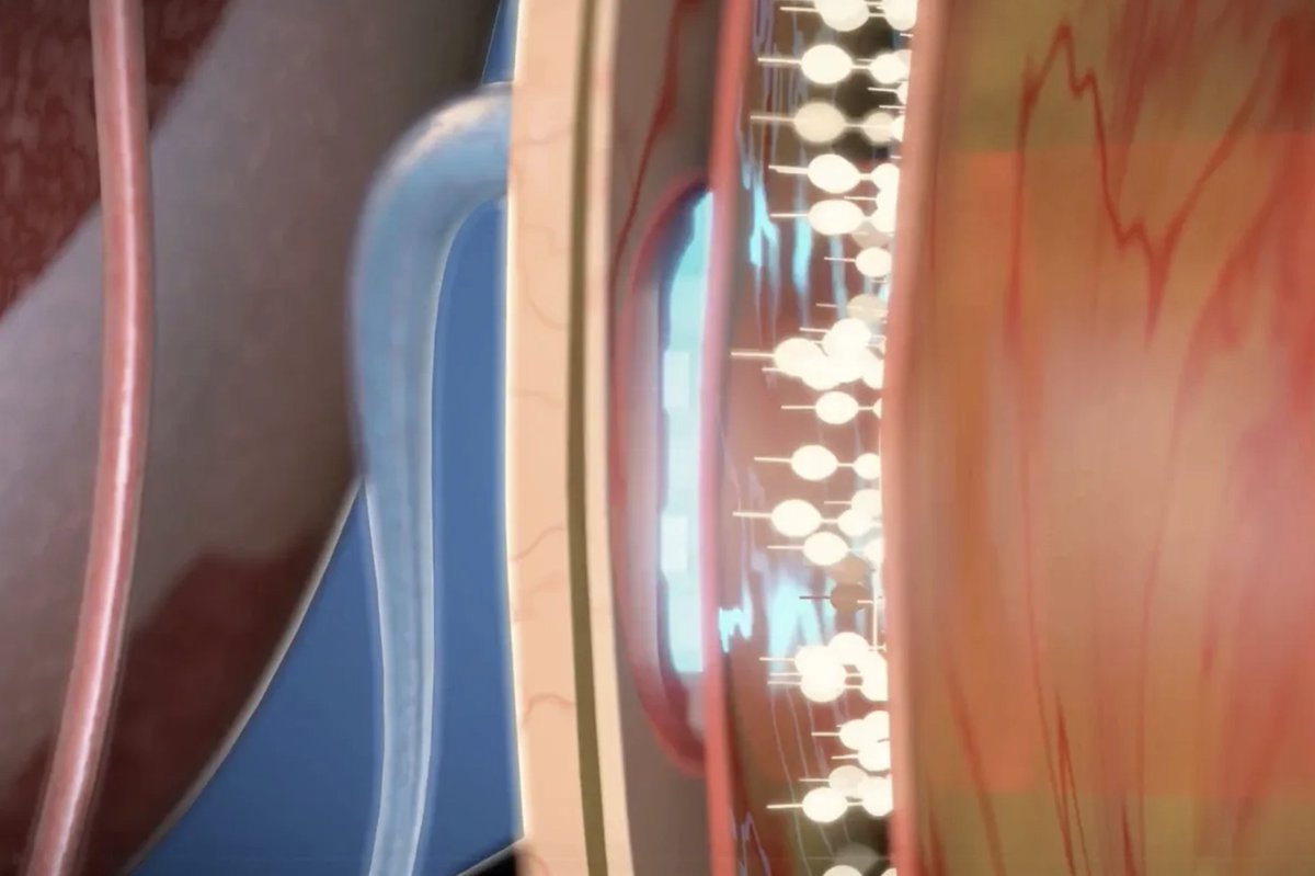 Eye Computer Terminal Brain Computer Interfaces Are Now Giving Sight Back to the Blind ...